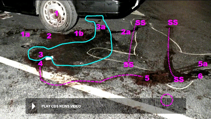 Similar view as above photo with added information. 1a and 1b are likely landing locations of both hands when Heitholt’s head slammed into left rear wheel rim/cover. 2a denotes drainage trail of blood from blood pool at 2 where Heitholt head came to rest at end of bloody assault. 3a – locale of Heitholt legs and feet after strangulation. Note how the victim’s legs wiped through the trail of blood at 2a. 4 – approximate location of Heitholt head after being turned over by sports writers. Dashed line from 4 to 5 – denotes path of movement of Heitholt’s head during relocation for resuscitation. 5a – dual trail of blood from head position during resuscitation. 6 – rotated position of Heitholt head and also another dual trail of blood. SS and dashed connecting lines – smearing and scrubbing markings made by an emergency scoop stretcher during process of removing body from scene. Dashed circle – approximately location of severed belt buckle. Modified still from CBS News video.